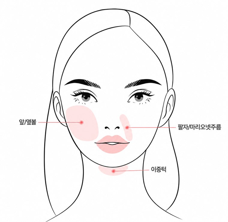 시술 부위 정면