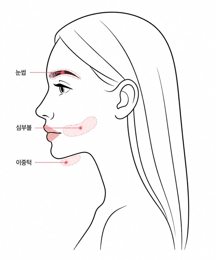 시술 부위 측면