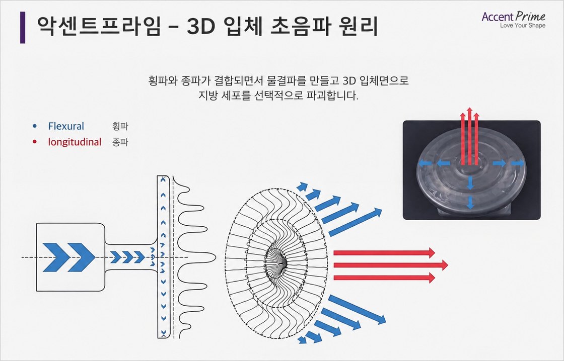 악센트프라임 3D 입체 초음파 원리 그림