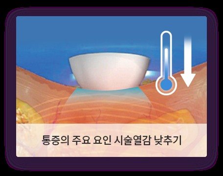 쿨링으로 시술 열감을 낮추는 원리를 그린 악센트프라임 설명 그림