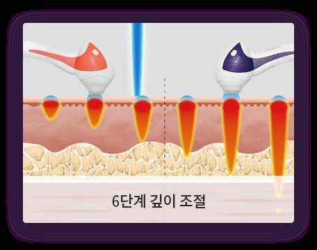 피부층 6단계 깊이 조절을 그린 악센트프라임 설명 그림