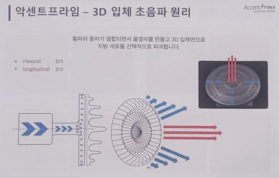악센트프라임 3D 입체 초음파 원리 그림