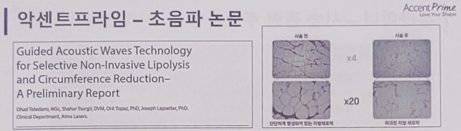 악센트프라임 초음파 논문 표지