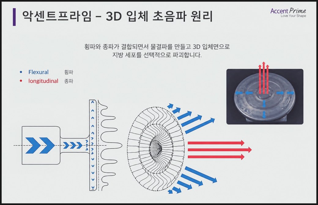 악센트프라임 3D 입체 초음파 원리 그림