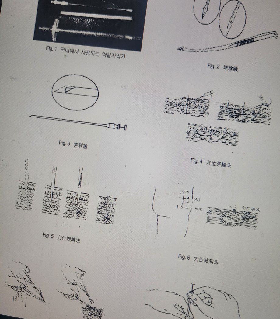 안면부 시술 교재