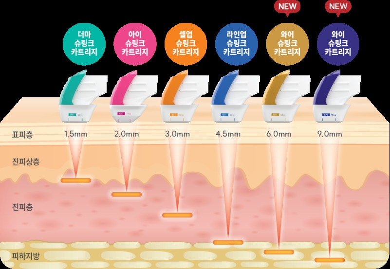 슈링크 카트리지별 초음파 에너지 조사 깊이 그림 (1.5mm부터 9.0mm까지)