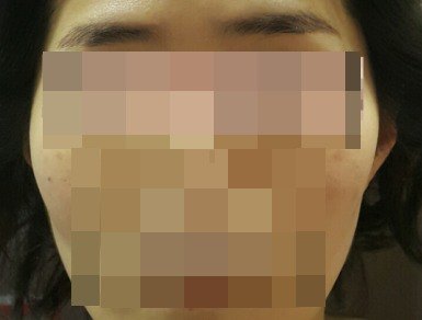 광대가 지나치게 부각된 케이스